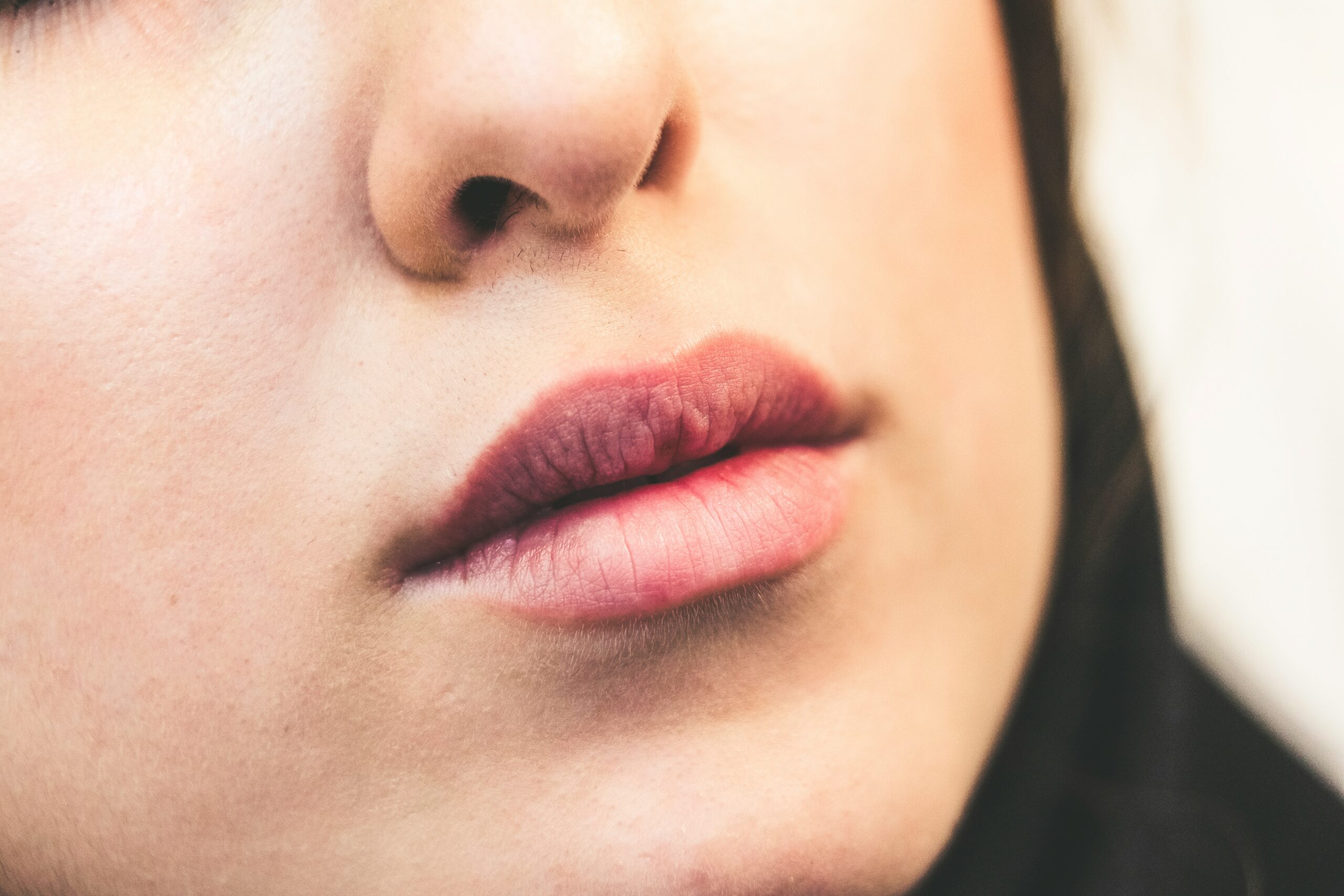 Female face - Dermal Fillers