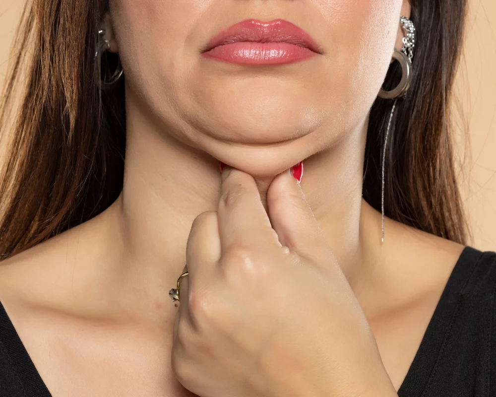 lemon bottle fat dissolving chin 7 Things You've Got to Know About Bottle! Lemon Bottle Fat Dissolving |