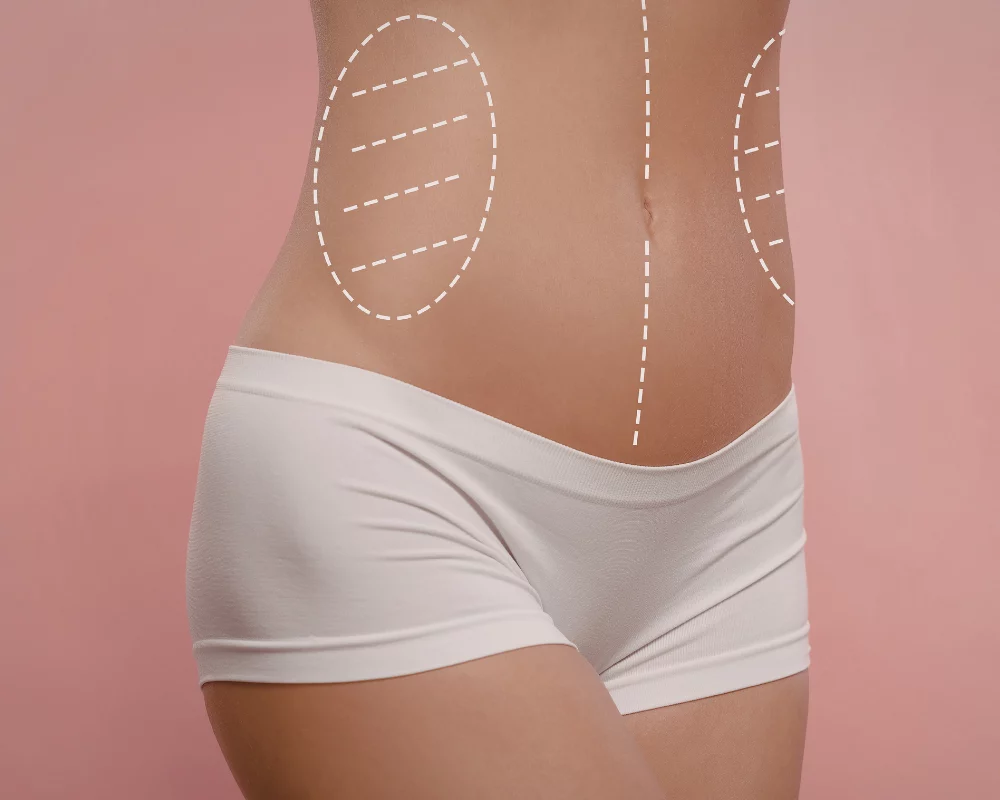 body contouring